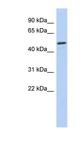 CHEK1 / CHK1 antibody LS-C109689 Western blot of Fetal Small Intestine lysate.