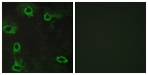 Immunofluorescence of COS7 cells, using ADORA2A Antibody. The sample on the right was incubated with synthetic peptide.