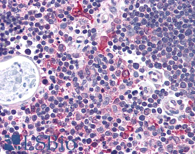 Anti-Chk1 antibody IHC of human thymus. Immunohistochemistry of formalin-fixed, paraffin-embedded tissue after heat-induced antigen retrieval. Antibody LS-B932 concentration 5 ug/ml.
