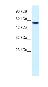 CHEK1 / CHK1 antibody LS-B932 Western blot of HepG2 cell lysate.