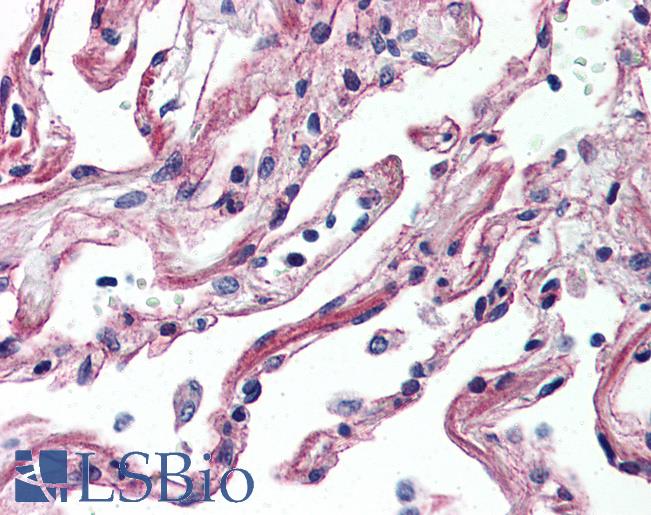 Anti-ADORA2A antibody LS-A1237 IHC of human lung. Immunohistochemistry of formalin-fixed, paraffin-embedded tissue after heat-induced antigen retrieval.