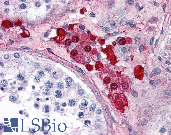 Anti-ADORA2A antibody LS-A1237 IHC of human testis. Immunohistochemistry of formalin-fixed, paraffin-embedded tissue after heat-induced antigen retrieval.
