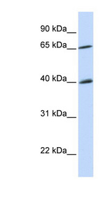 CHEK2 / CHK2 antibody LS-C109566 Western blot of Fetal Brain lysate.