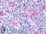 Anti-CMKLR1 antibody LS-A448 IHC of human thymus. Immunohistochemistry of formalin-fixed, paraffin-embedded tissue after heat-induced antigen retrieval.