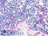 Anti-CMKLR1 antibody LS-A447 IHC of human thymus. Immunohistochemistry of formalin-fixed, paraffin-embedded tissue after heat-induced antigen retrieval.
