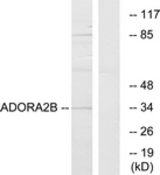 Western blot of extracts from Jurkat cells, using ADORA2B Antibody. The lane on the right is treated with the synthesized peptide.