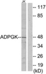 Western blot of extracts from Jurkat cells, using ADPGK Antibody. The lane on the right is treated with the synthesized peptide.