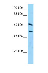 ADPRH antibody LS-C146268 Western blot of HeLa Cell lysate. Antibody concentration 1 ug/ml.