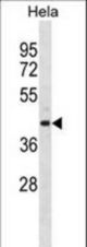 ADPRH Antibody western blot of HeLa cell line lysates (35 ug/lane). The ADPRH antibody detected the ADPRH protein (arrow).