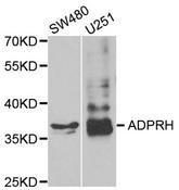 Western blot analysis of extracts of various cell lines, using ADPRH antibody.