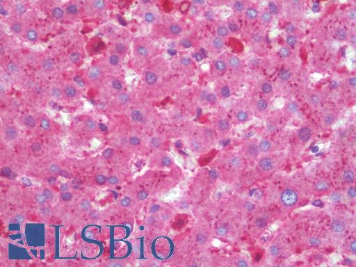 Anti-ADPRH / ARH1 antibody IHC staining of human liver. Immunohistochemistry of formalin-fixed, paraffin-embedded tissue after heat-induced antigen retrieval. Antibody LS-B9939 concentration 10 ug/ml.