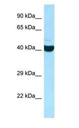 ADPRHL2 antibody Western Blot of HepG2.