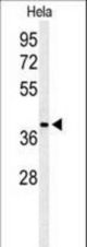 Western blot of ADPRHL2 Antibody in HeLa cell line lysates (35 ug/lane). ADPRHL2 (arrow) was detected using the purified antibody.