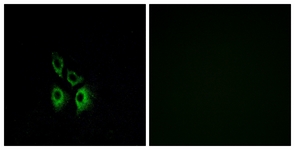 Immunofluorescence of A549 cells, using ADRA1A Antibody. The sample on the right was incubated with synthetic peptide.