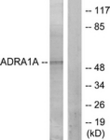 Western blot of extracts from lOVO cells, using ADRA1A Antibody. The lane on the right is treated with the synthesized peptide.
