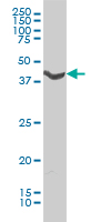 ADRA1A monoclonal antibody (M01), clone 4C7 Western Blot analysis of ADRA1A expression in HL-60.