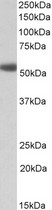 ADRA1A antibody (1 ug/ml) staining of Human Prostate lysate (35 ug protein in RIPA buffer). Primary incubation was 1 hour. Detected by chemiluminescence.