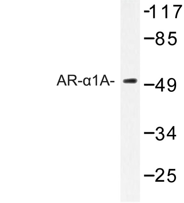 Western blot of AR-1A (Q365) pAb in extracts from lOVO cells.