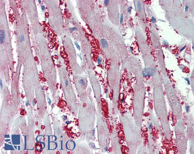 Anti-ADRA1A antibody IHC of human heart. Immunohistochemistry of formalin-fixed, paraffin-embedded tissue after heat-induced antigen retrieval. Antibody LS-B4077 concentration 10 ug/ml.