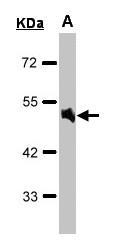 Sample(30 g of whole cell lysate). A: Raji. 10% SDS PAGE. ADRA1A antibody diluted at 1:1000.