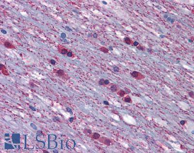 Anti-ADRA1A antibody LS-A1248 IHC of human brain. Immunohistochemistry of formalin-fixed, paraffin-embedded tissue after heat-induced antigen retrieval.