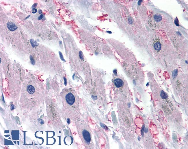 Anti-ADRA1A antibody IHC of human heart, heart failure. Immunohistochemistry of formalin-fixed, paraffin-embedded tissue after heat-induced antigen retrieval.