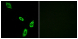 Immunofluorescence of LOVO cells, using ADRA1B Antibody. The picture on the right is treated with the synthesized peptide.