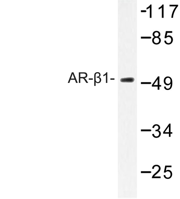 Western blot of AR-1 (A302) pAb in extracts from HT-29 cells.