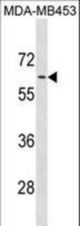 ADRA1B Antibody western blot of MDA-MB453 cell line lysates (35 ug/lane). The ADRA1B antibody detected the ADRA1B protein (arrow).