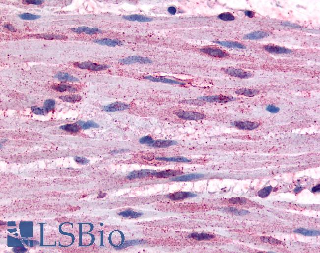 Anti-ADRA1B antibody LS-A696 IHC of human smooth muscle cells. Immunohistochemistry of formalin-fixed, paraffin-embedded tissue after heat-induced antigen retrieval.
