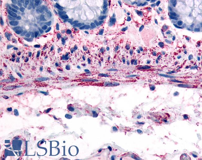 Anti-ADRA1B antibody LS-A699 IHC of human smooth muscle cells. Immunohistochemistry of formalin-fixed, paraffin-embedded tissue after heat-induced antigen retrieval.