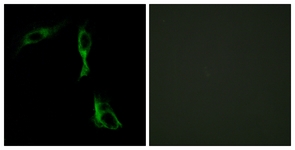 Immunofluorescence of HeLa cells, using ADRA1D Antibody. The sample on the right was incubated with synthetic peptide.