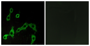 Immunofluorescence of LOVO cells, using ADRA2A Antibody. The picture on the right is treated with the synthesized peptide.