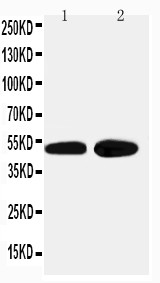 WB of ADRA2A antibody. Lane 1: HELA Cell Lysate. Lane 2: PANC Cell Lysate.