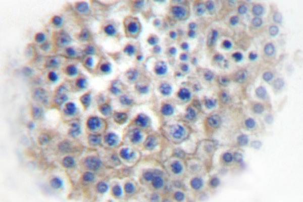 IHC of AR 2A (R361) pAb in paraffin-embedded human testis tissue.