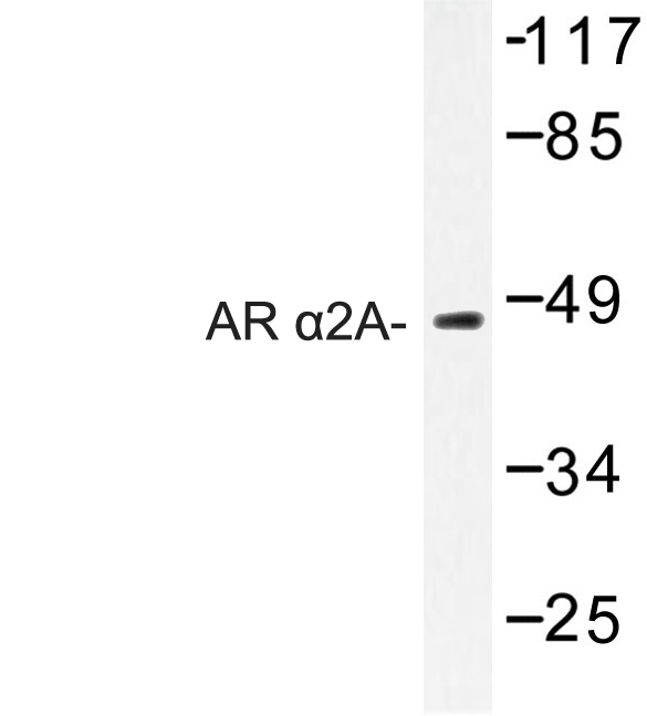 Western blot of AR 2A (R361) pAb in extracts from Jurkat cells.