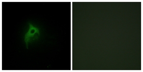 Immunofluorescence of HepG2 cells, using Adrenergic Receptor alpha-2B Antibody. The picture on the right is treated with the synthesized peptide.