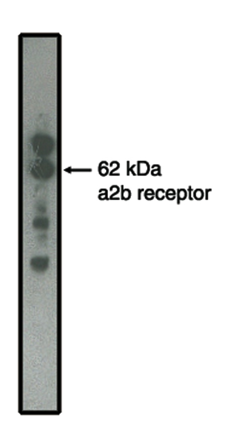 Western blot of alpha2B adrenergic receptor antibody on MDCK cells transfected to produce alpha2B receptor protein.
