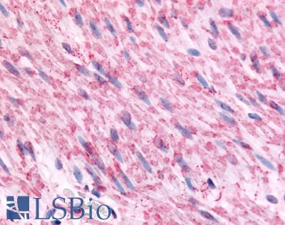 Anti-ADRA2C antibody LS-A3988 IHC of human artery, smooth muscle. Immunohistochemistry of formalin-fixed, paraffin-embedded tissue after heat-induced antigen retrieval.