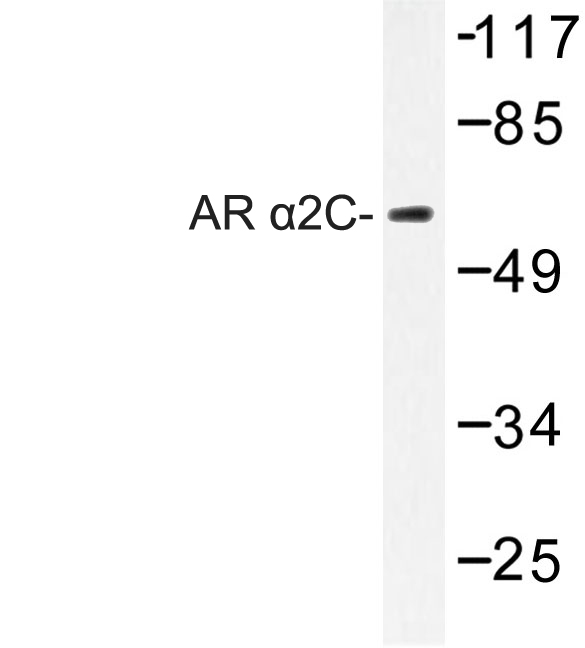 Western blot of AR 2C (R369) pAb in extracts from HepG2 cells.