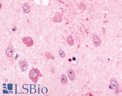 Anti-ADRA2C antibody LS-A3990 IHC of human brain, neurons of area ca1. Immunohistochemistry of formalin-fixed, paraffin-embedded tissue after heat-induced antigen retrieval.