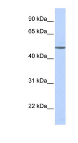 ADRB1 antibody LS-C110177 Western blot of Fetal Brain lysate.