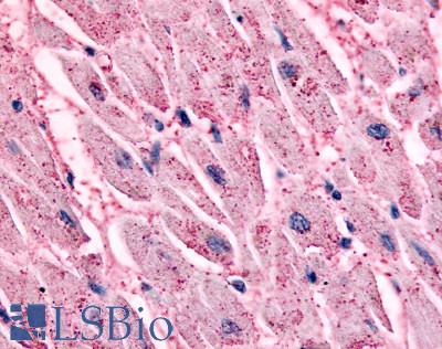 Anti-ADRB2 antibody LS-A2663 IHC of human heart, cardiac myocytes. Immunohistochemistry of formalin-fixed, paraffin-embedded tissue after heat-induced antigen retrieval.