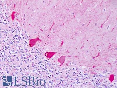 Anti-ADRB2 antibody IHC of human brain, cerebellum. Immunohistochemistry of formalin-fixed, paraffin-embedded tissue after heat-induced antigen retrieval. Antibody LS-A2662 dilution 2.8-4.6 ug/ml.