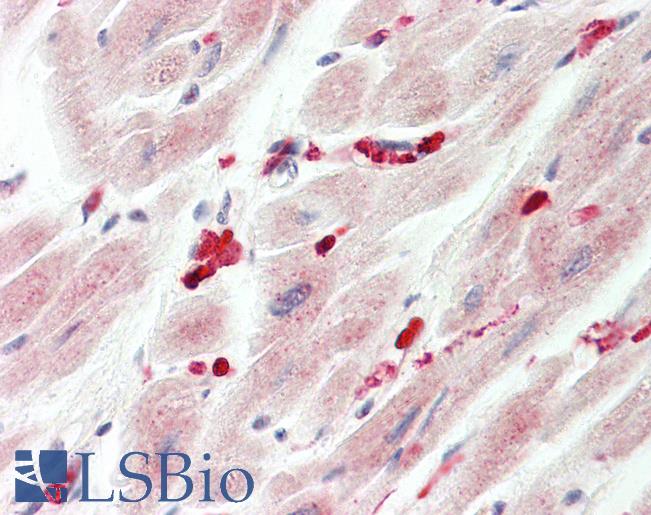 Anti-ADRB2 antibody IHC staining of human heart. Immunohistochemistry of formalin-fixed, paraffin-embedded tissue after heat-induced antigen retrieval. Antibody LS-B10030 dilution 1:100.