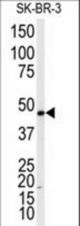 Western blot of anti-ADRB2 Antibody (T384) in SK-BR-3 cell line lysates (35 ug/lane). ADRB2 (arrow) was detected using the purified antibody.