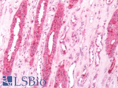 Human Kidney: Formalin-Fixed, Paraffin-Embedded (FFPE)