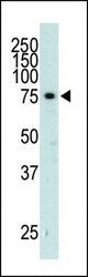 The anti-GRK3 antibody is used in Western blot to detect GRK3 in mouse heart tissue lysate.