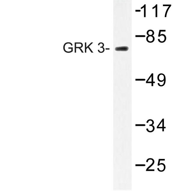 Western blot of GRK 3 (F391) pAb in extracts from HepG2 cells.