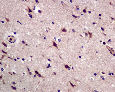 IHC of paraffin-embedded human brain tissue using anti-GRK3 antibody.